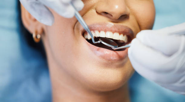 Best Knocked-Out Tooth (Avulsed Tooth) Treatment in Walbridge, OH