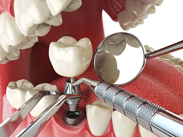Best Emergency Cosmetic Dentistry (e.g., broken veneers) in Walbridge, OH